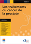 Les traitements du cancer de la prostate Image 1